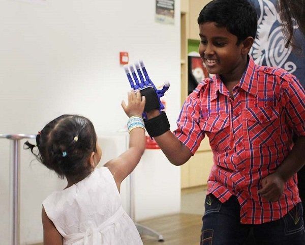 Padmaloshn high fives little sister with new 3D printed hand. - Materialise.