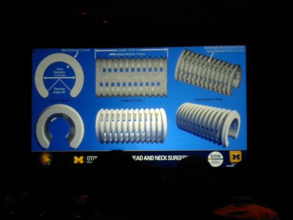University of Michigan 4D Printed trachea splint      University of Michigan 4D Printed trachea splint