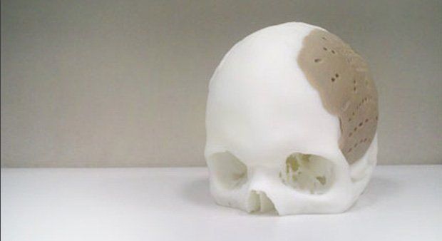 OsteoFab - Oxford Performance Materials