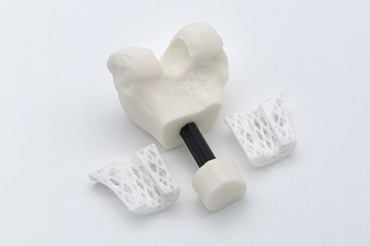 BellaSeno’s 3D printed PCL Bone Scaffold graft cage. - BellaSeno