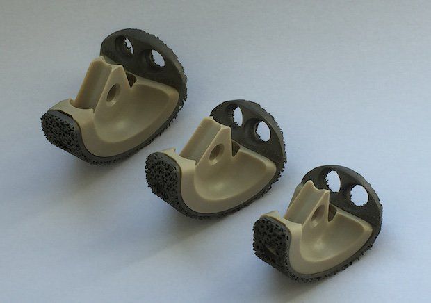 Ulnar implant available in three sizes.