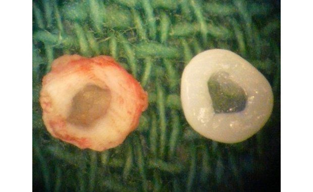 3D Printed Spinal Disc - Bossnar Research Group