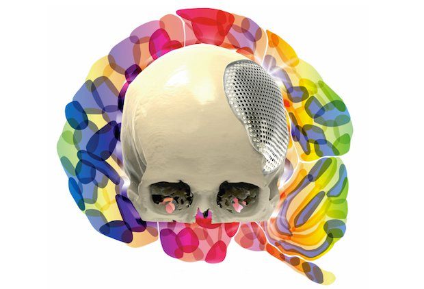 The brains behind metal additive manufacturing