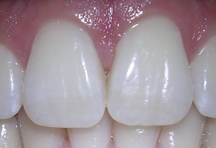 Teeth      The growth of dental 3D printing applications may drive the industry's growth. - Dozenist via Wikimedia Commons
