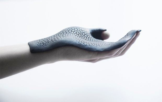 Windform 3D printed Orthosis hand