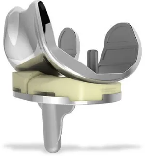Conformis