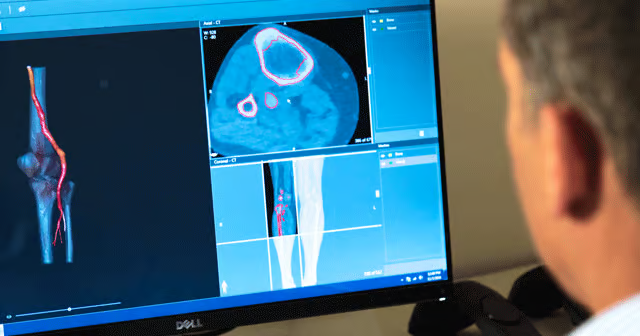 3D Systems obtains FDA 510(k) clearance for VSP Orthopedics virtual surgical planning for skeletally mature adolescents