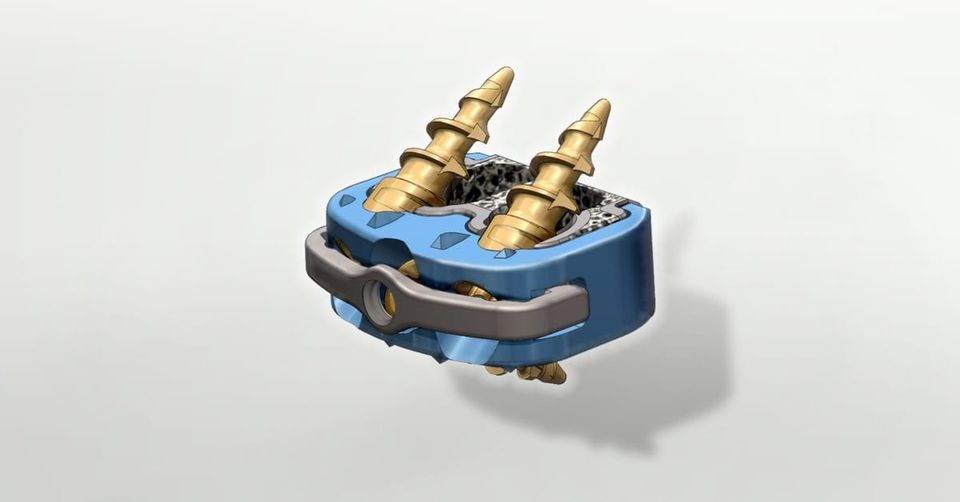 Lincotek 3D printed-enabled SpineLinc Anterior Cervical Implant System gains FDA 510(k) clearance