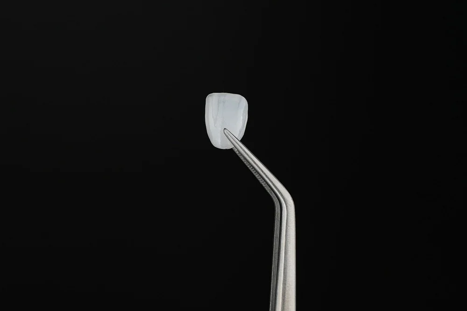 Application spotlight: 100-micron 3D printed veneers enable reduction in teeth grinding for patients