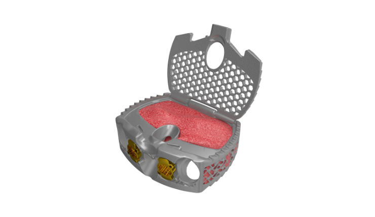 Spinal Elements' 3D printed Ventana A ALIF devices receives FDA 510(k) clearance
