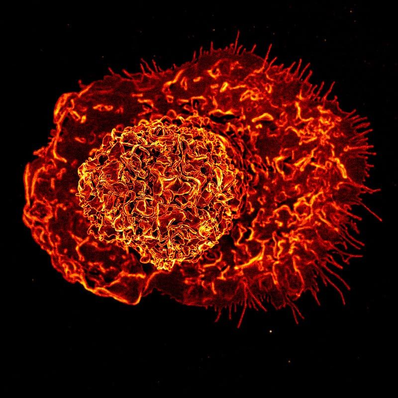 A macrophage