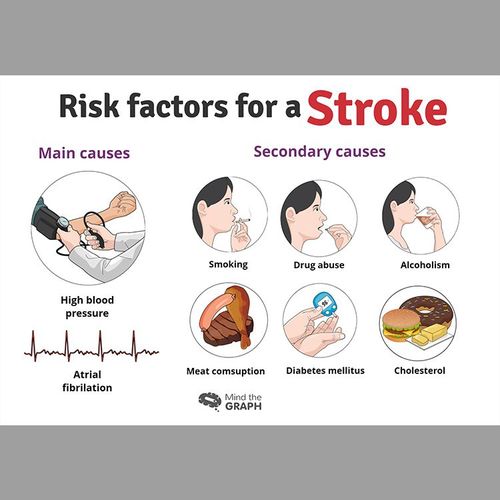 Best Ways to Cut Your Stroke Risk
