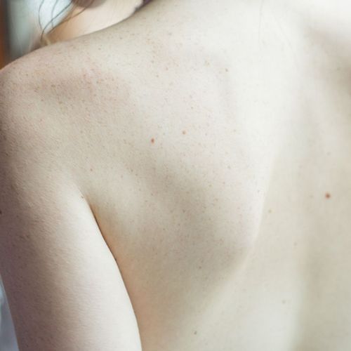 Safer, Easier Way to Heal a Herniated Disk