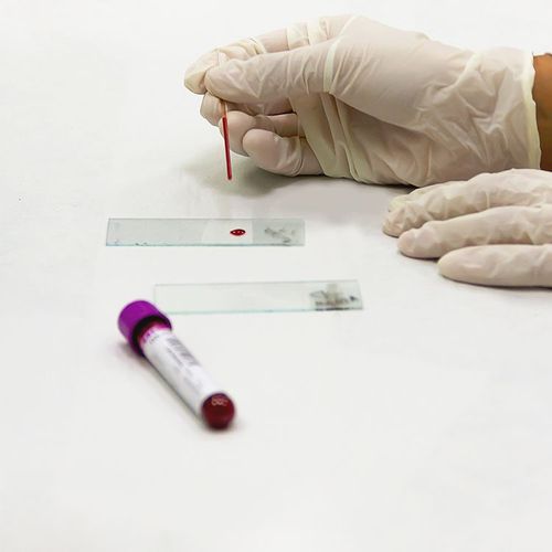 New, Easy-to-Manage Blood Thinner Could Replace Warfarin