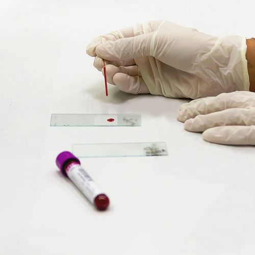 Newer Blood Thinner Dangerous for Trauma Patients
