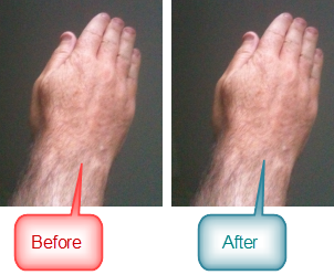 AuraBand_Before_After