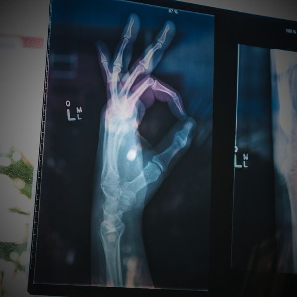 Eppure le Analisi vanno bene...