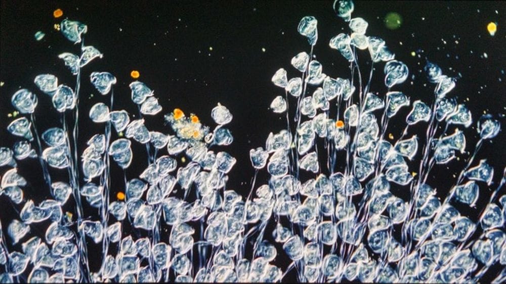 What appear to be organisms under a microscope.