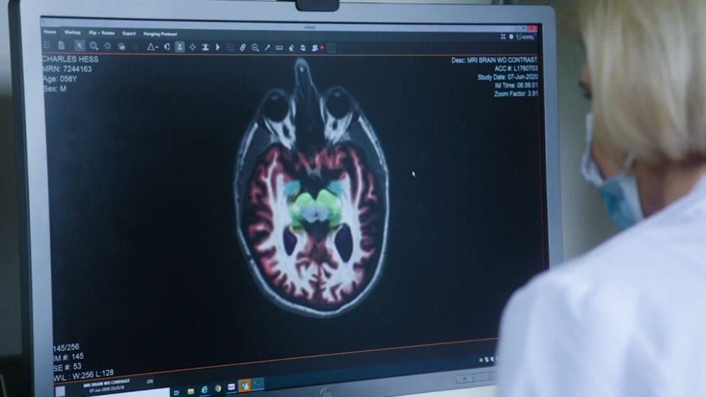 A doctor looks at a computer monitor showing a scan of somebody's brain.