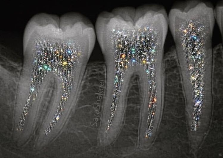 Japan’s Revolutionary Tooth Regrowth Drug Could Change Dentistry Forever