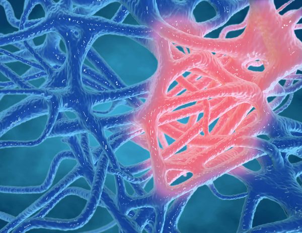 Unmasking the Silent Killer: What is Chronic Inflammation and How to Combat it