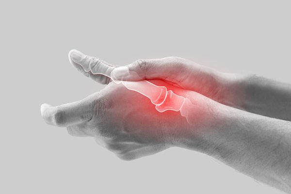 Arthritis and Inflammation Uncovered: Discover the Complex Connection and How to Manage It Effectively