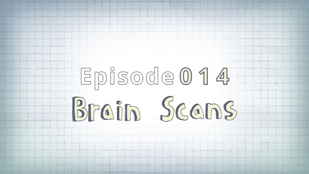 014: Brain Scans