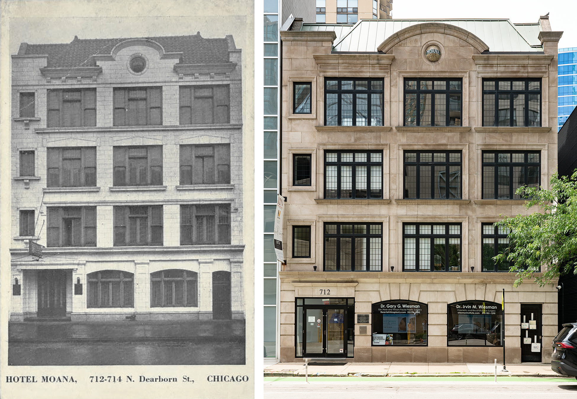 Black and white photo postcard on the left: a white four story building, a hanging sign, a demisphere just below the roof line. 2026 photo on the right: building now faced in beige stone, different windows, signs on the first floor for Dr. Gary and Irvin Wiesman.