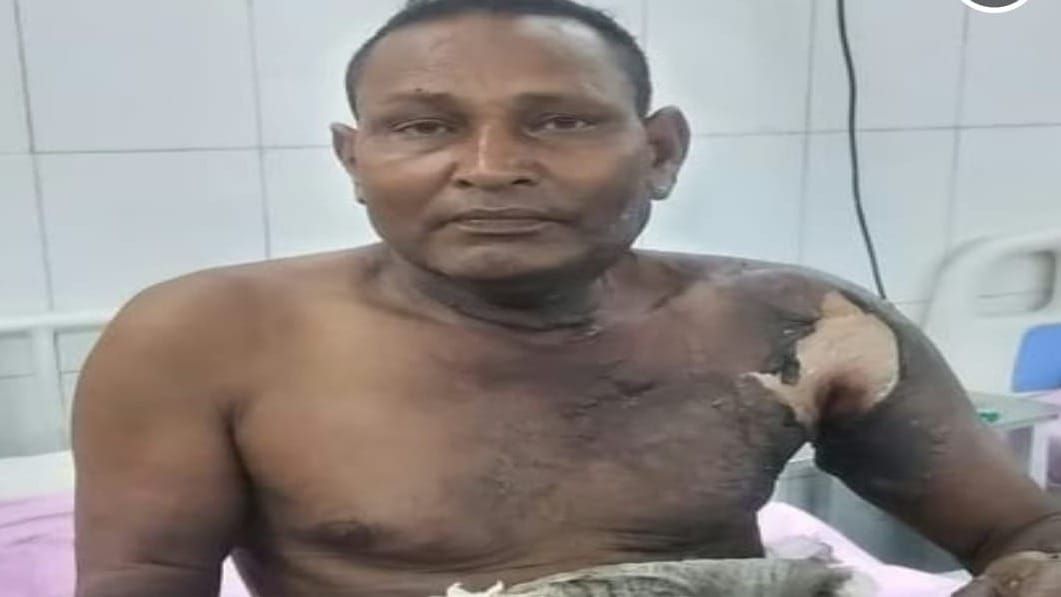 जिंदा जलाने की कोशिश, पुलिस की गिरफ्त में पूर्व प्रधान का बेटा.!