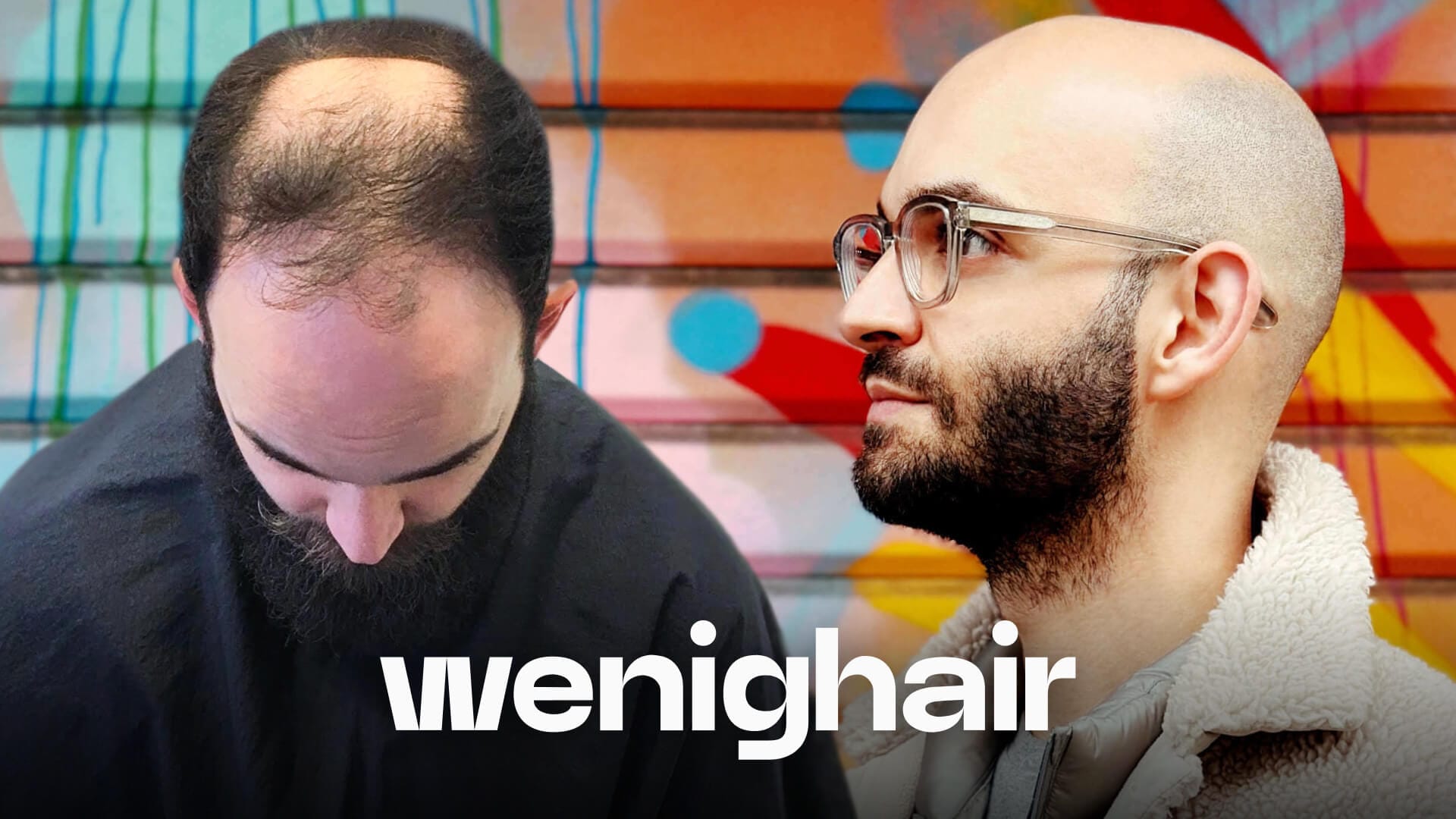 wenighair Glatze-Transformation: Erfolgreiche SEO-Strategie für über 200 Top-Rankings bei Haarausfall-Keywords