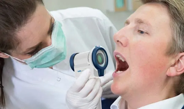 London Drugs set to launch oral cancer screenings