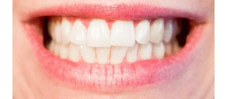 CVS and Walgreens test in-store dental services