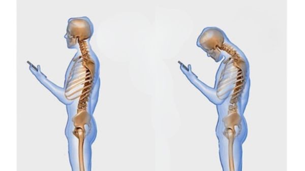 Tech Neck & Modern Posture: How Technology Shapes Our Bodies—and How to Restore Balance