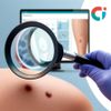 AI Can Spot Early Risk Patterns for Skin Cancer