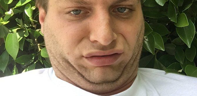 King Krule vs. Mac Demarco: A clash between two disenchanted hipsters