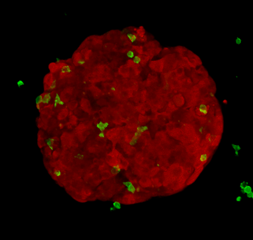 Yes we can-cer: shrinking tumours by boosting the immune system