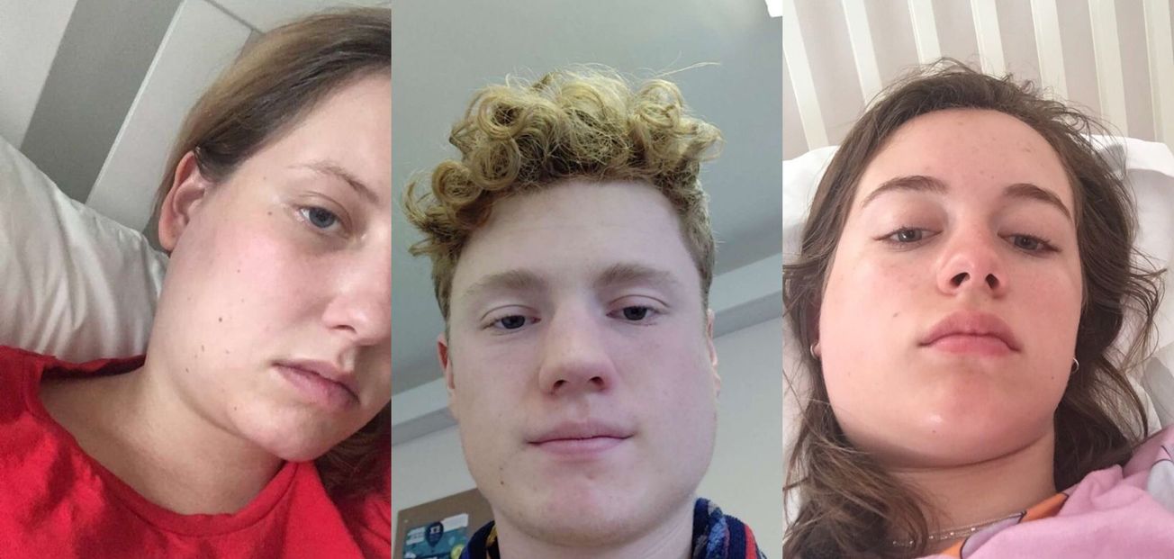 ‘I literally looked like a hamster!’: The rise of mumps at universities