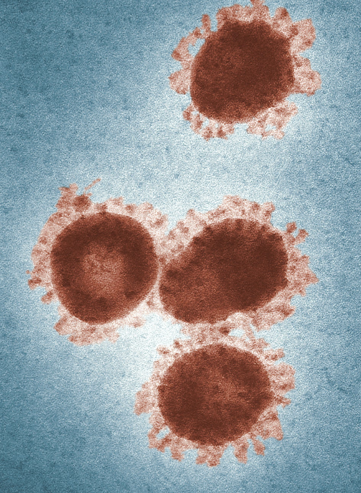 Opinion | The University should close, because all universities should be forced to close