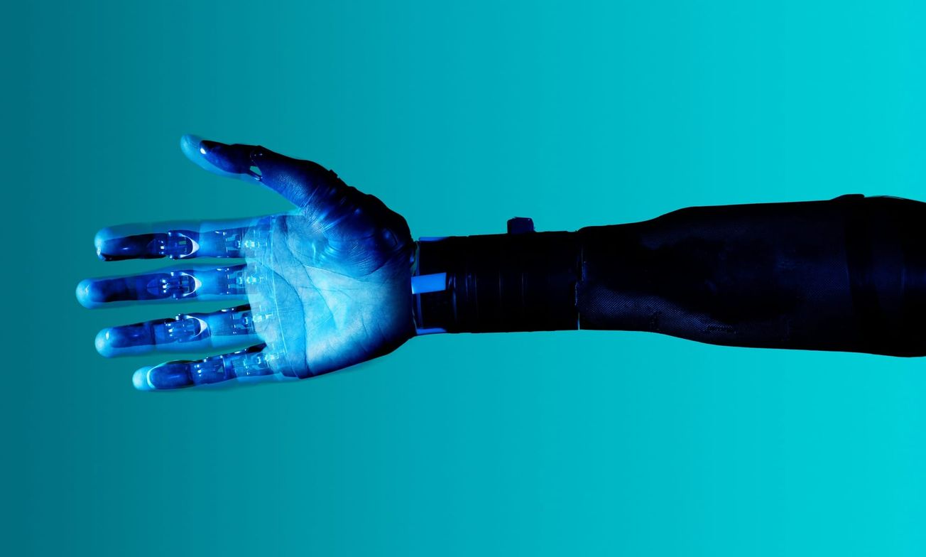 Ghosts in the nervous system: The neuroscience behind phantom limbs