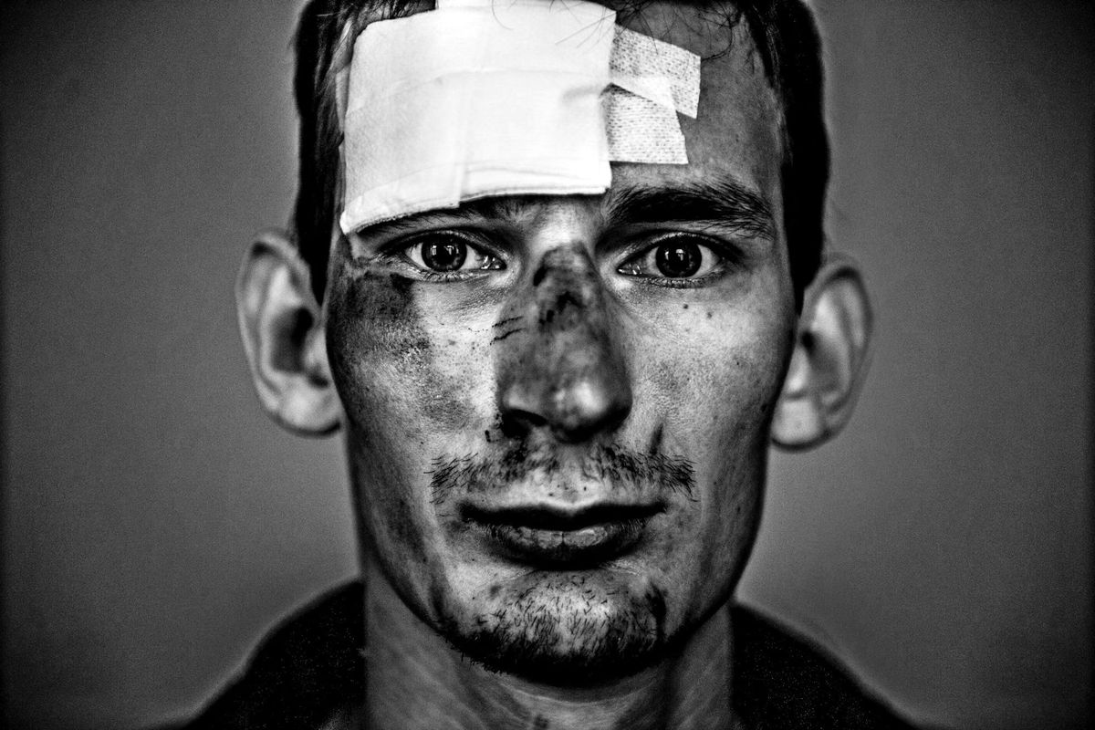 September 14 – Wounds and Transformation