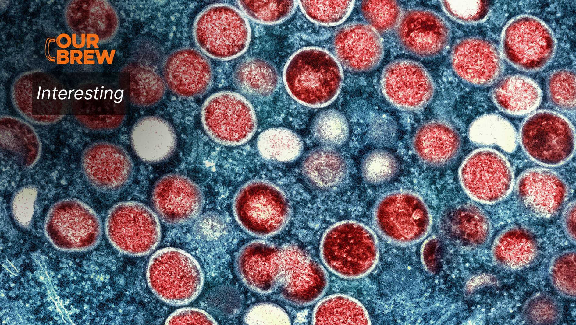 The Monkeypox Epidemic Is Unusual: Here's How I Know