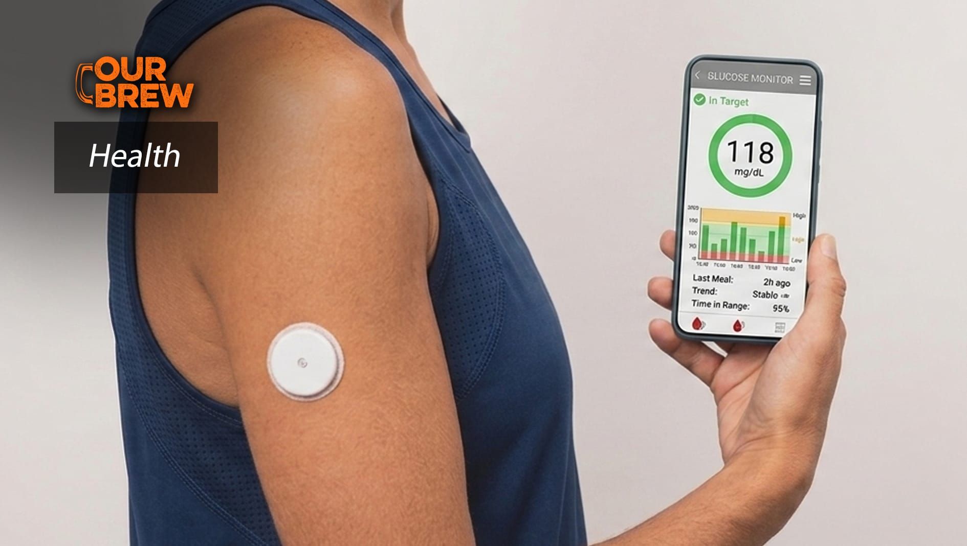 Wearable Glucose Monitors Offer Real‑time Data, but for Healthy People No Guidelines Exist to Interpret the Numbers