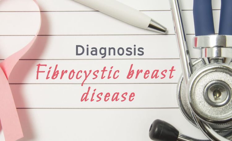 Fibrocystic Breast Disease
