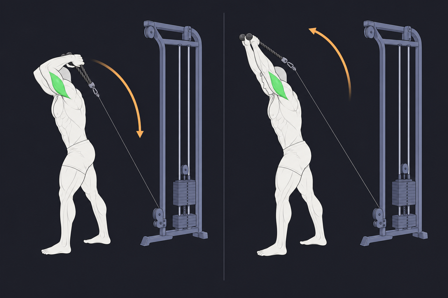 5. Overhead Cable Triceps Extension — start and finish position