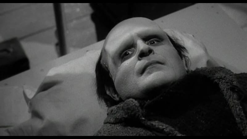 «Молодой Франкенштейн» (1974)