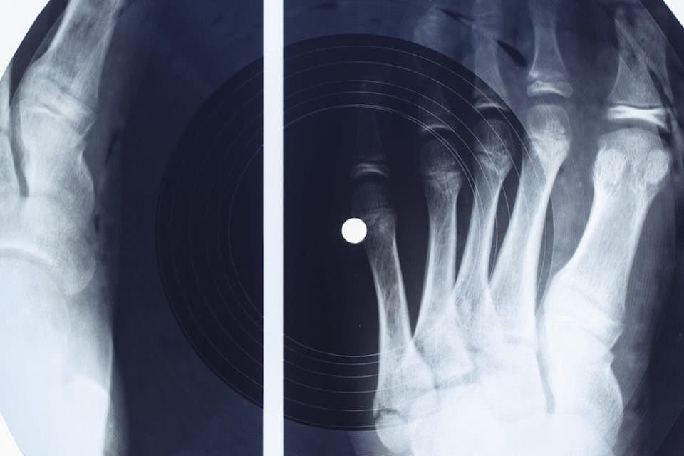 Версия «Всё идёт по плану» от Massive Attack на рентгеновском снимке