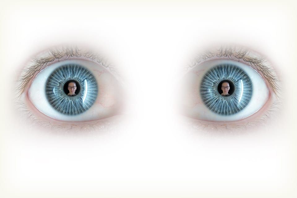 Eye Know