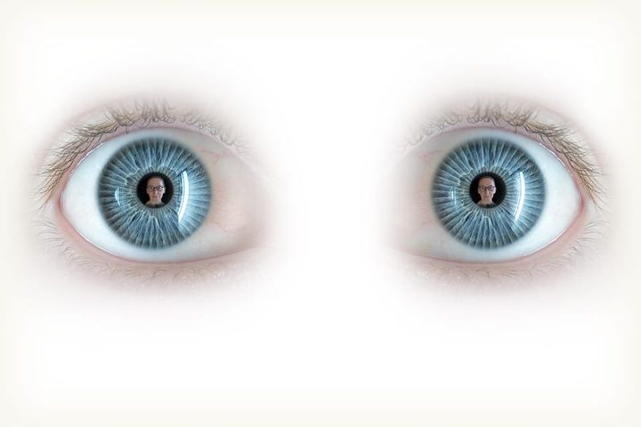 Eye Know