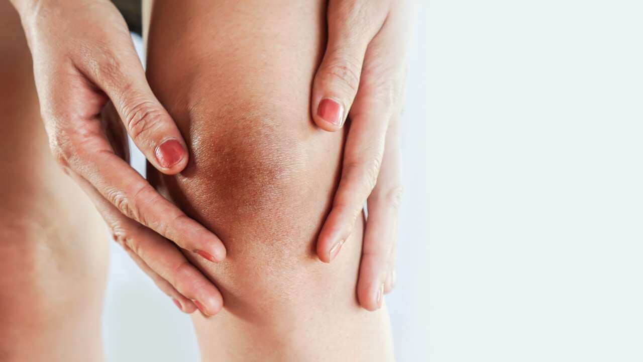 Closeup of woman touching the darker skin around her left knee area due to skin damage caused by sun exposure.