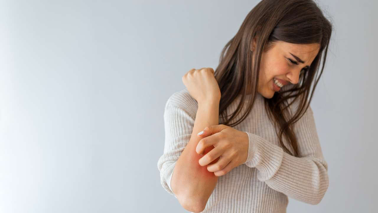 Woman in severe discomfort due to potential irritants, causing her to scratch the reddened and inflamed skin on her forearm.